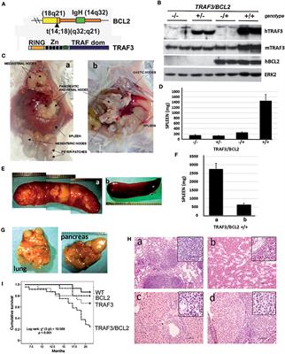 Dysregulated TRAF3 and BCL2 Expression Promotes Multiple Classes of Mature Non-hodgkin B Cell Lymphoma in Mice